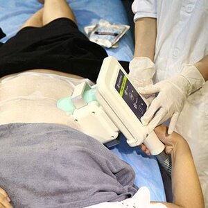 Cryolipolyse Heerhugowaard image 2