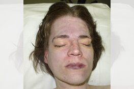 Wassenaar - Gezocht - Onbekende dode vrouw in duinen